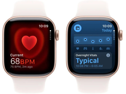 Смарт-годинник Apple Watch Series 10 GPS 46mm Rose Gold Alu. Case w. Light Blush Sport Band - M/L (MWWU3)  Фото №2
